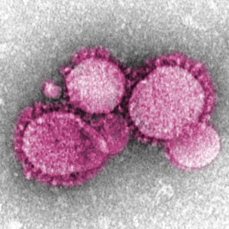 Worldwide, cases of the coronavirus have reached 110,200. 3,835 people have died, 3,119 being in China.