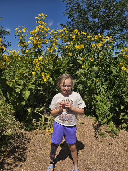 Bella Lentsch has had seven prosthetics in the span of her life, that's one prosthetic for every year she has been alive. 